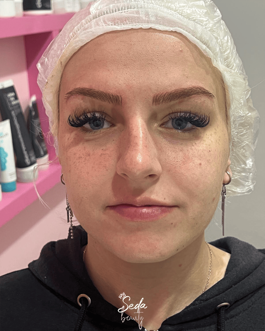 Skincare mistakes that damage your skin barrier and reduce the effectiveness of daily care routines.