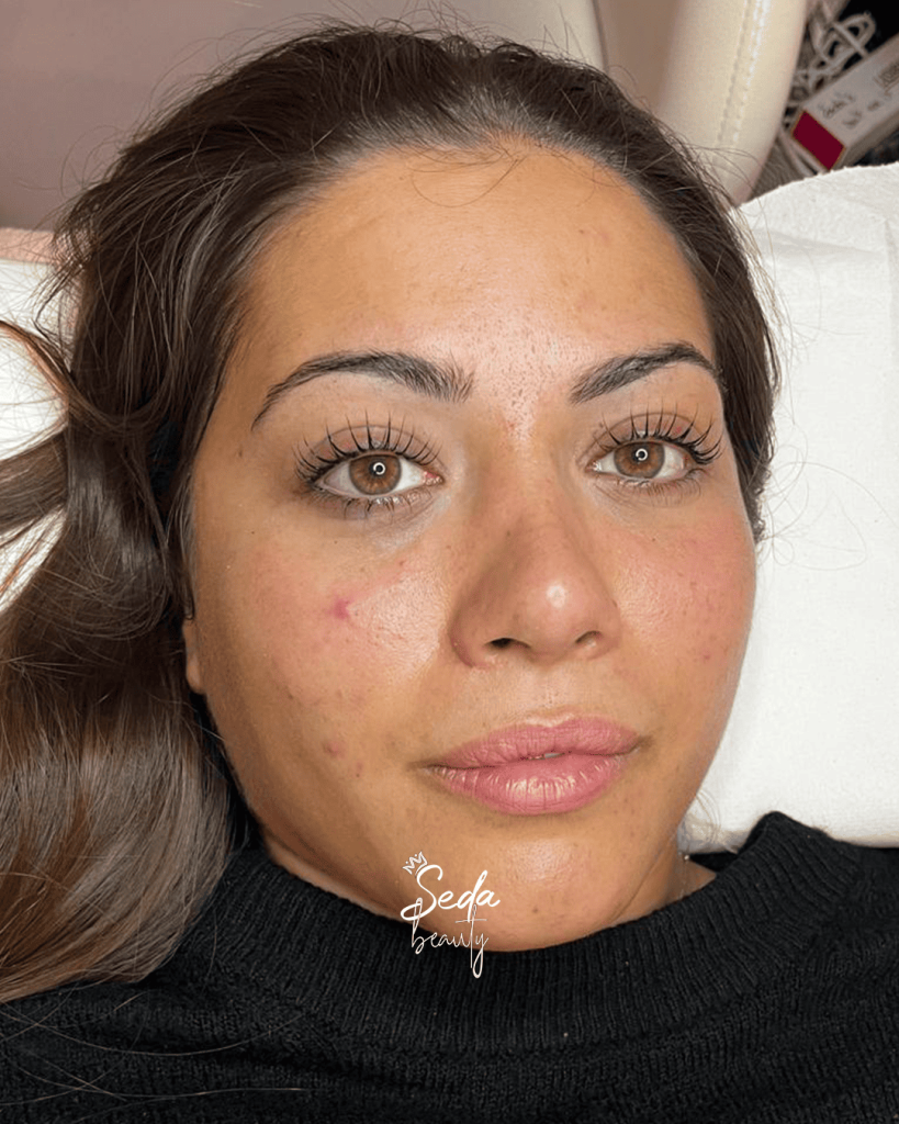 Effective anti wrinkle face care routine to reduce fine lines and enhance smooth, radiant skin.