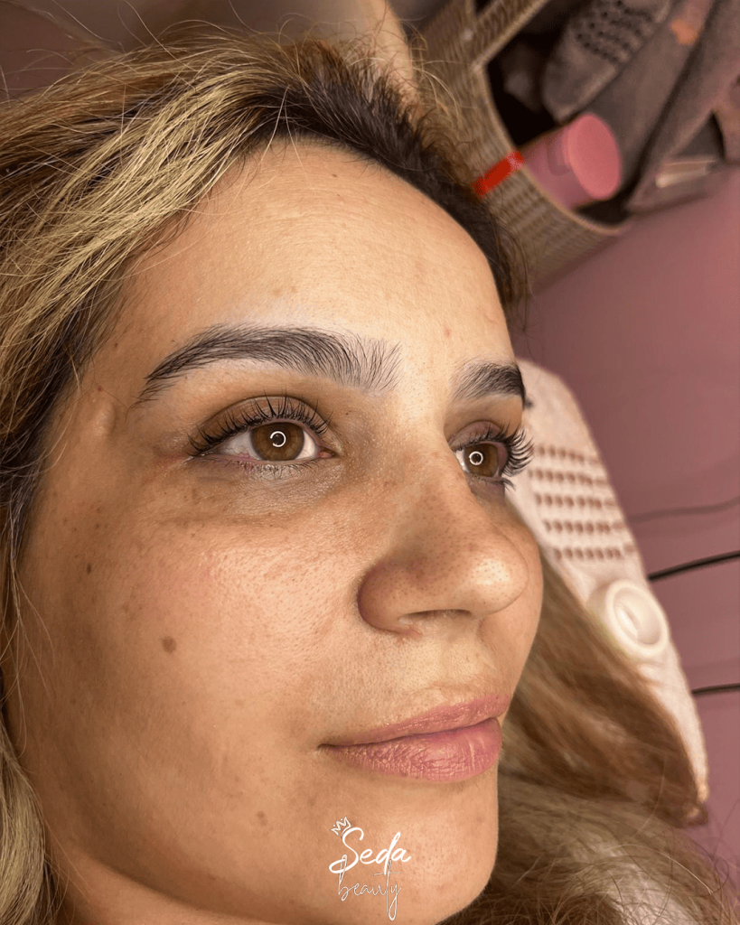 Why Is My Skin Always Dry? (Causes & Fixes) 2 Establishing a consistent dry skin routine helps keep your skin hydrated and prevents flakiness throughout winter.